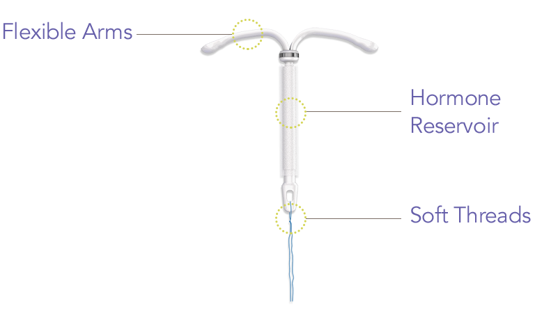 Kyleena® (levonorgestrel-releasing intrauterine system) 19.5 mg IUD diagram shows its flexible arms, hormone reservoir and soft threads.